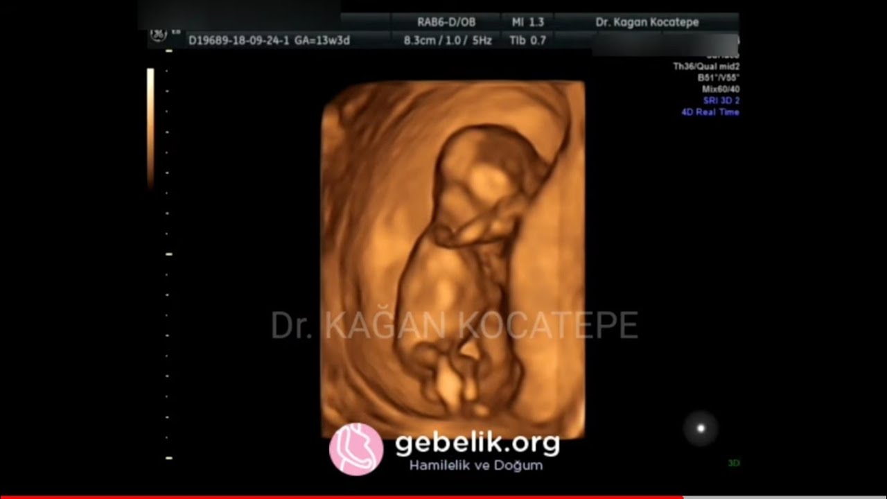 13 5 haftalik 3 aylik bebek ultrason goruntuleri aciklamali boyu nedir cinsiyet belli olur mu youtube