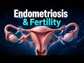 How Endometriosis Can Affect Female Fertility | 3D Medical Animation #shorts