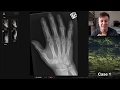 Isolation tutorial: Upper limb x-ray with Andrew Dixon