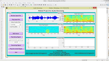 Audio Denoising using Matlab Project