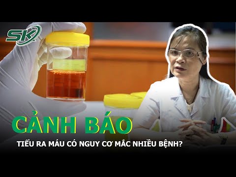 Video Màu Sắc Nước Tiểu Bất Thường Nói Lên Điều Gì Về Cơ Thể... - youtube
