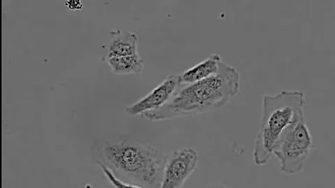 HeLa Cells time lapse