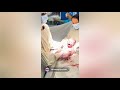 فیلم کامل زایمان سزارین فیلم کامل زایمان سزارین