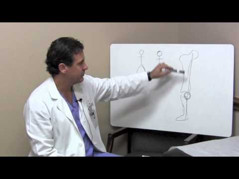 Avoiding Total Knee Replacement - Dr. J. Michael Bennett