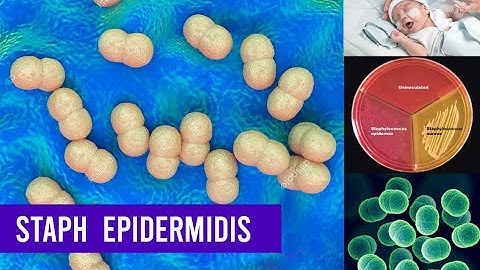 Staphylococcus Epidermidis Bacteria ( Complete Overview )