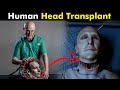 Human Head Transplant Surgery | Is Head Transplant Possible? (Urdu/Hindi)