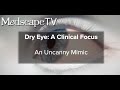 MedscapeTV • Dry Eye: A Clinical Focus - Episode 1: An Uncanny Mimic