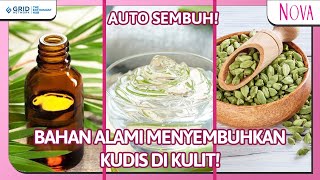 Cara Menghilangkan Kudis di Kulit, Cuman Pakai Bahan Alami Kulit Kembali Mulus