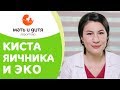 👪  При каких видах кист яичников возможна процедура ЭКО. ЭКО при эндометриоидной кисте яичника. 12+