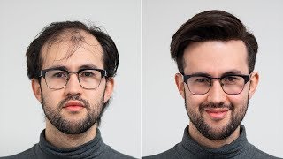 Textured Undercut For Men | Transformation with hairsystem | Hairsystems Heydecke