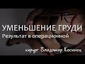 Уменьшение груди (редукционная маммопластика) - хирург Владимир Косинец. Результат в операционной