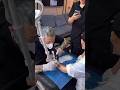 RUIPU--Co2 Fractional laser colorful tattoo removal treatment with effect results🔥🔥🔥