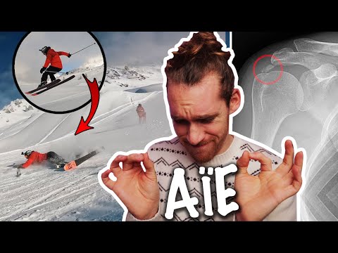 72 HOURS TO LEARN FREESTYLE SKIING (it hurts)!