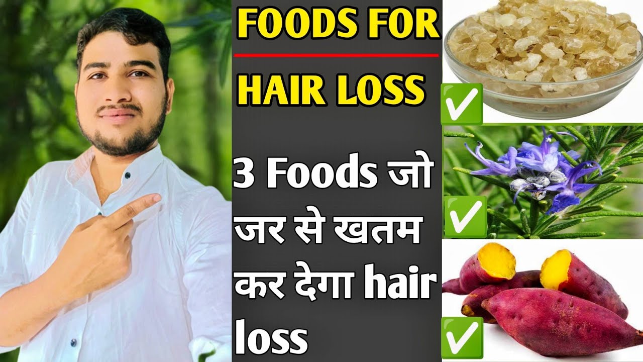 3 FOODS FOR HAIR LOSS DIET FOR HEALTHY HAIR Male pattern baldness