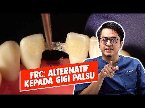 Video: Jembatan Yang Hilang Dan Orang-orang Kecil - Pandangan Alternatif