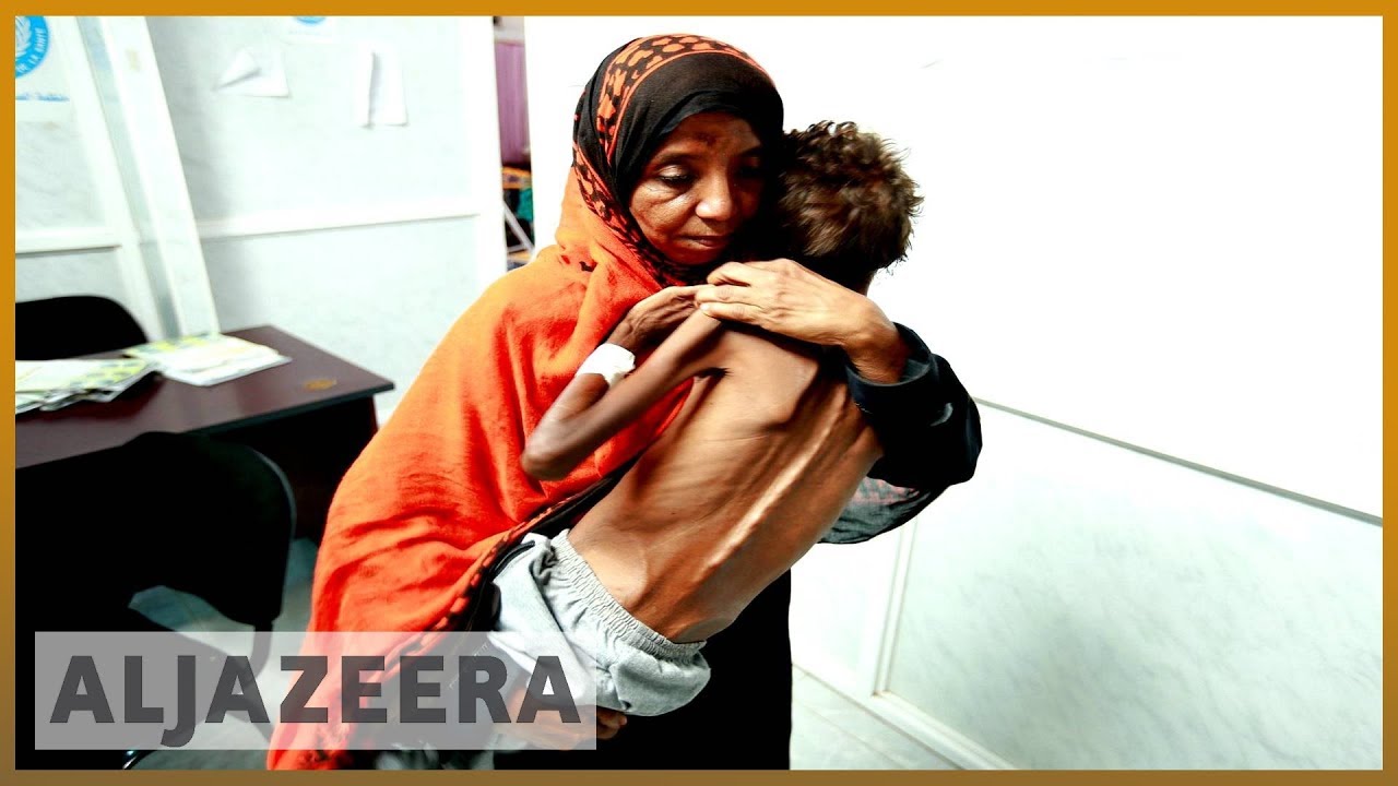 🇾🇪 آلاف الأطفال اليمنيين يعانون من سوء التغذية | الجزيرة الإنجليزية