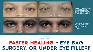Faster Recovery  Under Eye Filler or Lower Blepharoplasty?