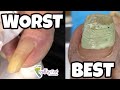 TWO INCH TOENAILS AND LONG GREEN NAILS | WORST AND BEST NAIL TRIMMINGS