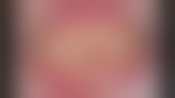 [성인인증필수ㅜㅜ] 내 인생 역대급 GBR (Opentex로 빵빵하게 뼈 넣고 잘 덮은 노하우 공개)