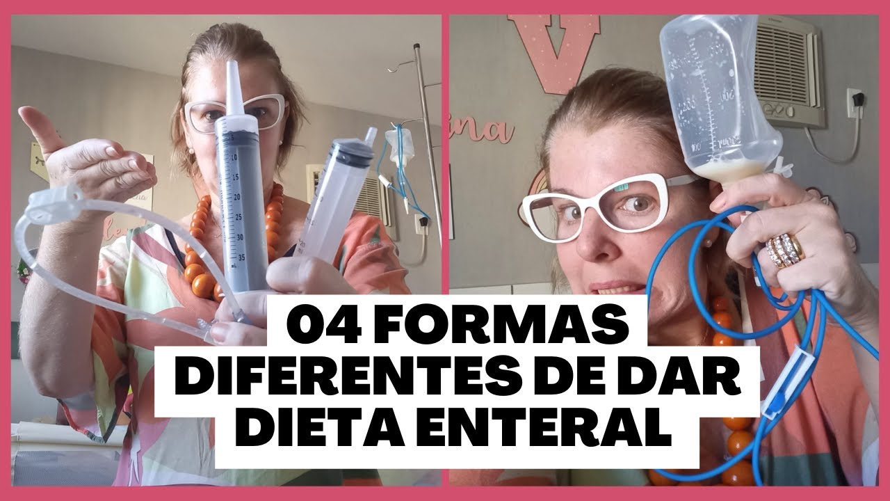 04 Formas diferentes de dar alimentação via GASTROSTOMIA (GTT). #gtt #gastrostomia