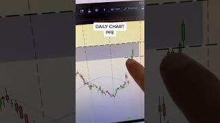 HOW TO TRADE GAPS! DAY TRADING GAPS WITH OPTIONS! OPTIONS DAY TRADING! THE BEST DAY TRADING SETUP!