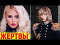 Жертвы пластики. Сергей Зверев до и после пластики