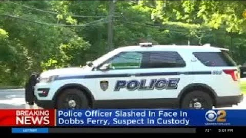 Police Officer Slashed In Face In Dobbs Ferry, Sus...