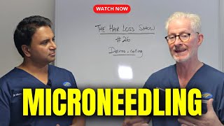 Derma-rolling and Micro-needling | The Hair Loss Show