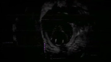 Hinn Chasing Music [ Psycho Mode ]