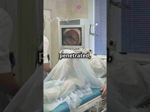 Endoscopic Ultrasound in