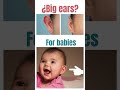 Bebé con orejas grandes? Tienes que ver esto!