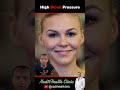 5 Hidden Signs of High Blood Pressure - Reel 5 #lifeisbutadream #urduhealth #doctor #hospital