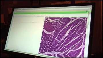 i-Human Patient Virtual Simulations | IMSH 2015 Video Demo Interview