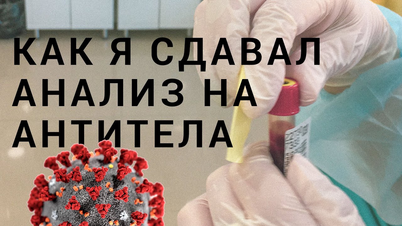Сойти сдавать. Сойти сдавать