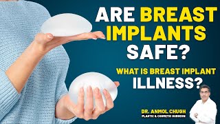 Famous Are Breast Implants Safe? What is Breast Implant Illness | Signs, Symptoms & Solutions Wealth