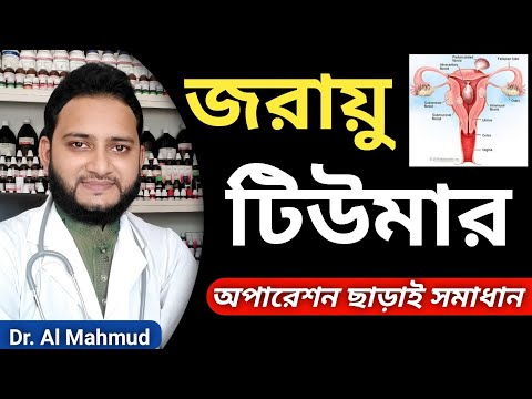 জর য ট উম র Uterine Fibroid Uterus Tumor Symptoms চ ক ৎস Without Surgery খ দম হ হ ম ও হল