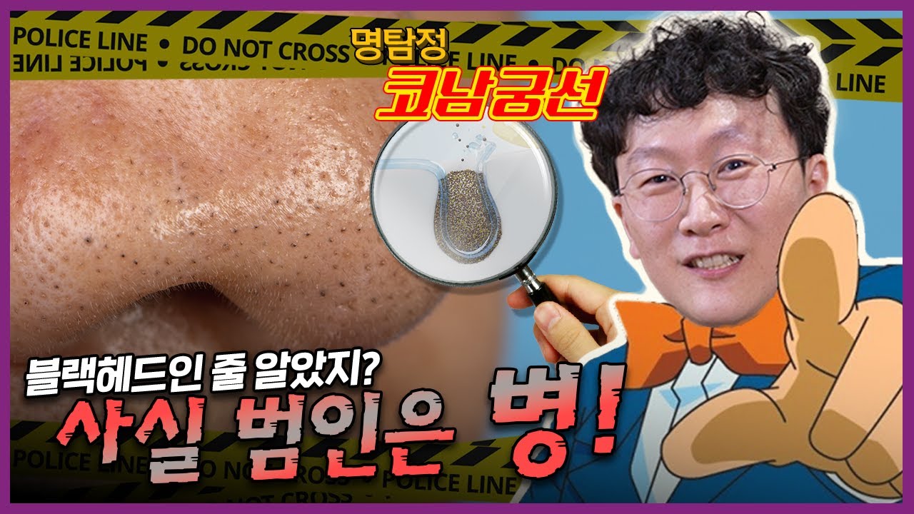 모공 속 까만 점의 정체, 충격적인 진실😱 - YouTube