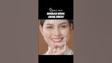 Invisalign versus Lingual braces!