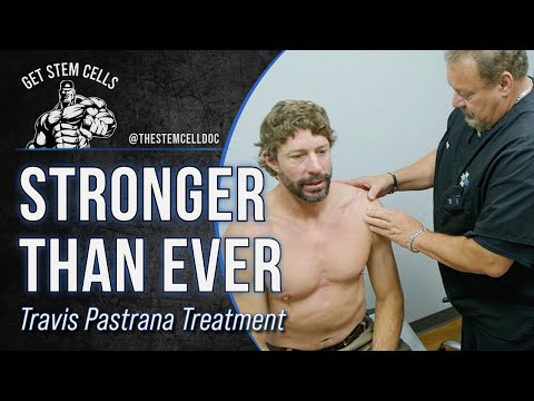Why Travis Pastrana Trusts Regenerative Medicine at The Stem Cell Doc