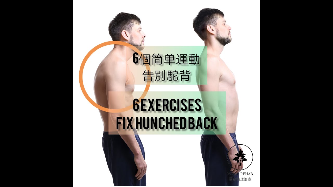 6 Super Effective Exercises to Fix Hunched Back! 6个简单运动告别驼背！