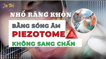 Sóng siêu âm Piezotome - Nhổ răng không đau - Không sưng - Không sang chấn #rangkhon