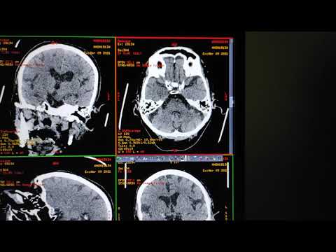 Vídeo: Reconstrução Antropológica: Como Restaurar As Características Faciais Do Crânio - Visão Alternativa