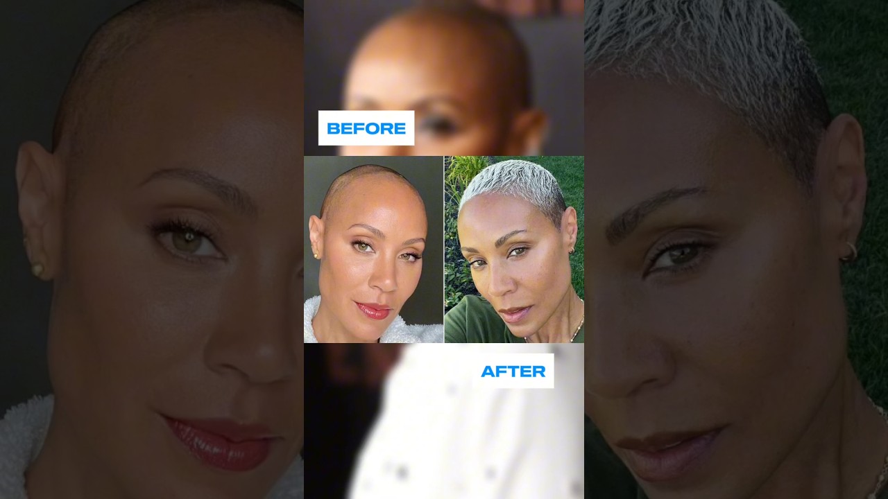 Jada Pinkett Smith's Hair Growth 