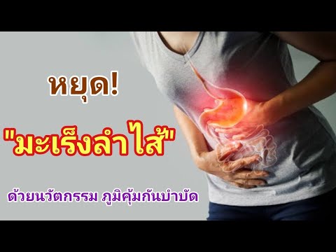 ภูมิคุ้มกันบำบัด - หมอนัดผ่าตัดมะเร็งลำไส้ แต่หามะเร็งไม่เจอหลังทานงานวิจัยนี้