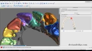 Information Blue Sky Plan Aligner Case Workup Example Guide