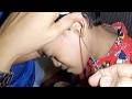 Removing Something STUCK in Boy & Girl's EAR | Watch till the END