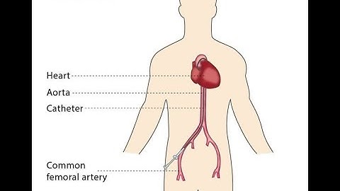 Vascular Catheterization | Selective | Non selective | Angiography - Dr Rams Medical Coding Academy