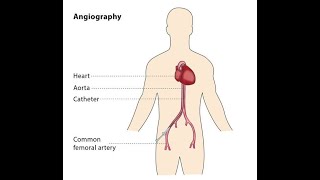 Vascular Catheterization Selective Non Selective Angiography - Dr Rams Medical Coding Academy