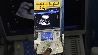 pregnant music to make baby move in womb, My first baby 👶🏻 19week ultrasound..subscribe for more.