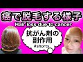 【癌・脱毛】卵巣癌で抗がん剤治療 #shorts Ovarian cancer